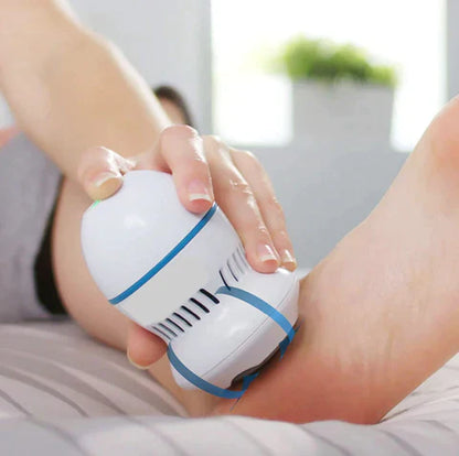 Modern Glow Co Vacuum Callus Remover