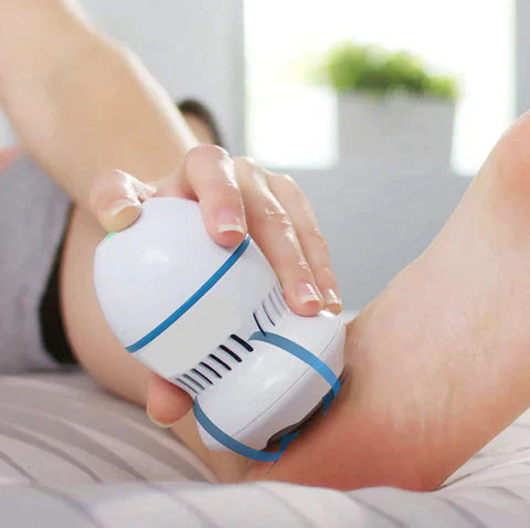 Modern Glow Co Vacuum Callus Remover
